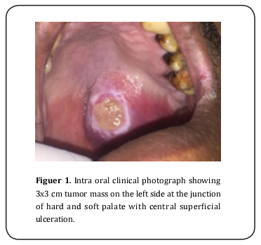 Figure 1.   