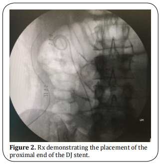 fig 2.  