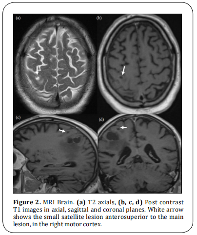 fig 2.  