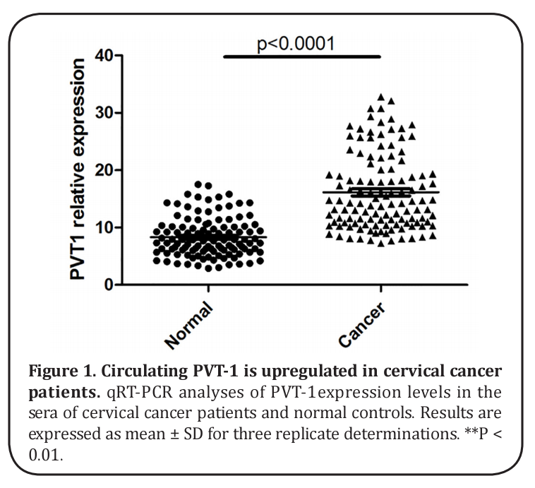 Figure 1. Circulating PVT-1 is upregulated in cervical cancer 
patients. 