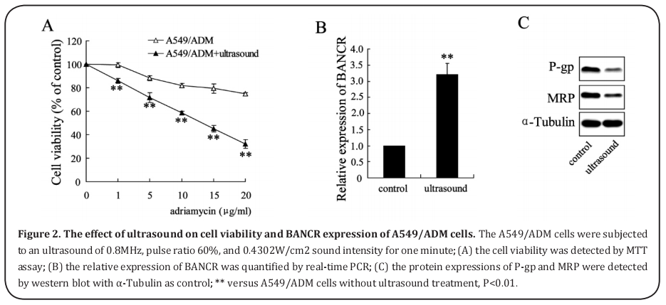 Figure 2. The effect of ultrasound on cell viability and BANCR expression of A549/ADM cells. 