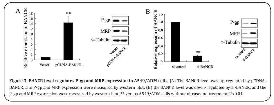 Figure 3. BANCR level regulates P-gp and MRP expression in A549/ADM cells.  