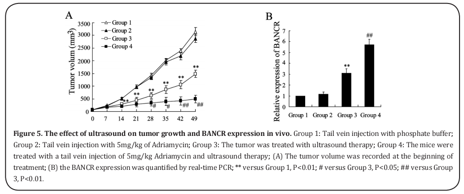 Figure 5. The effect of ultrasound on tumor growth and BANCR expression in vivo. 