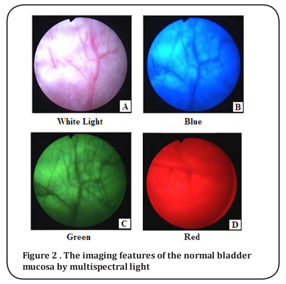Figure 2 . The imaging features of the normal bladder 
mucosa by multispectral light