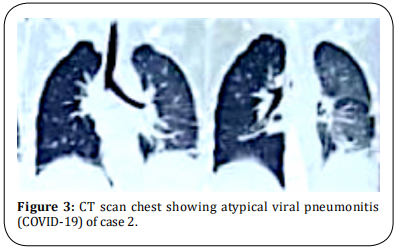 Figure 3.  