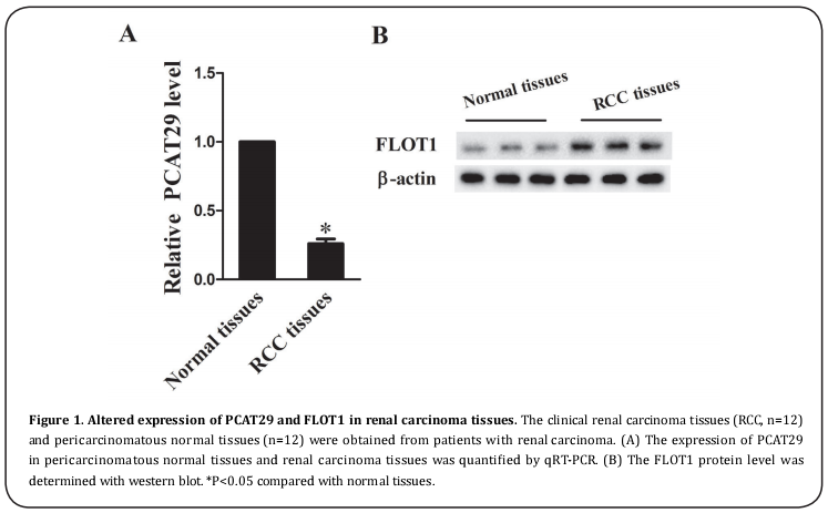 Figure 1. Altered expression of PCAT29 and FLOT1 in renal carcinoma tissues.  